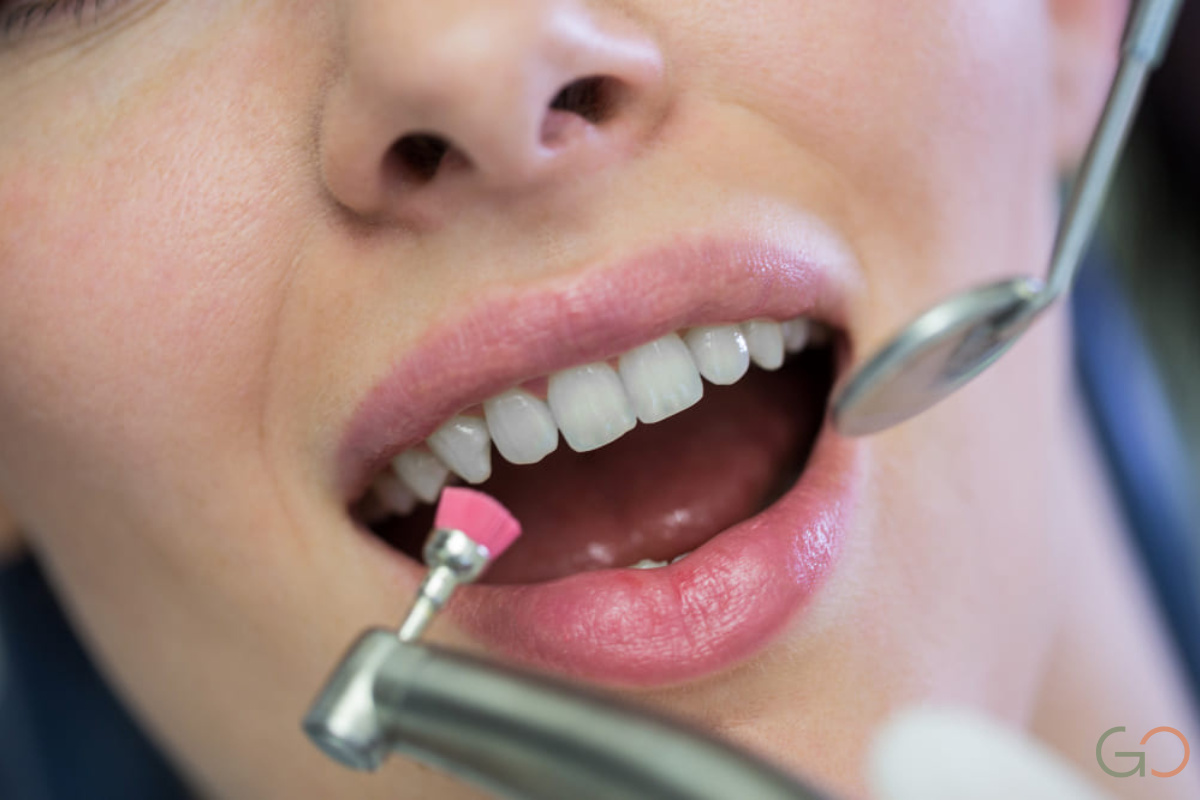 Lee más sobre el artículo Coronas dentales sobre dientes endodonciados: ¿por qué son necesarias?