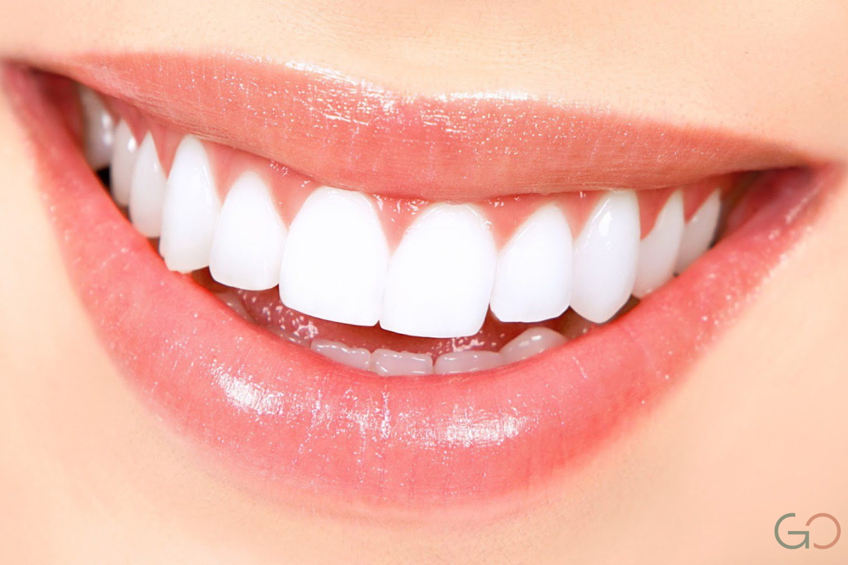 Lee más sobre el artículo Errores comunes al usar carillas dentales y cómo evitarlos