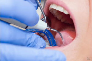 Lee más sobre el artículo Para qué sirve la rehabilitación dental