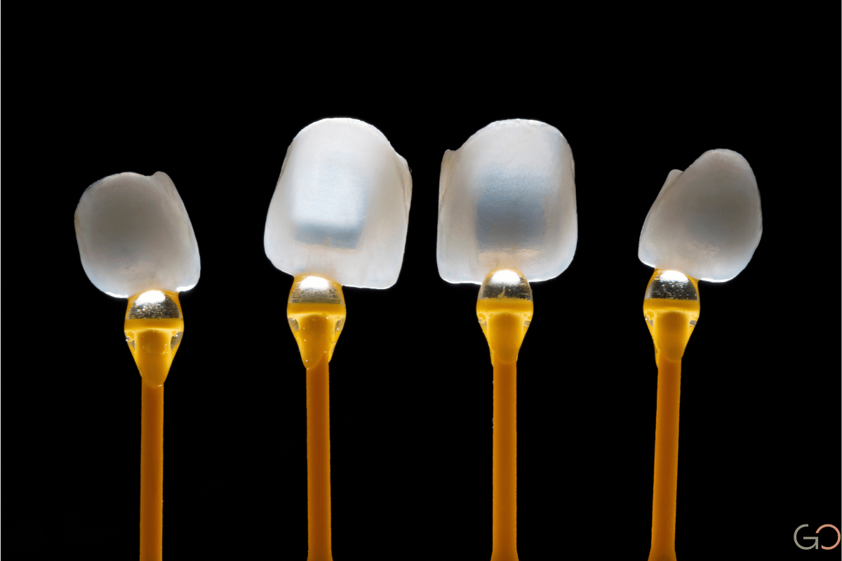 Lee más sobre el artículo ¿Cuál es el precio de las carillas dentales para toda la boca?