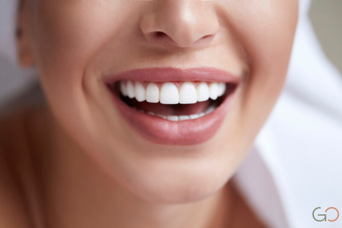 Lee más sobre el artículo ¿Qué pasa si se rompe una carilla dental? Opciones de reparación y reemplazo