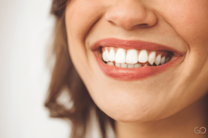 Lee más sobre el artículo Carillas dentales en pacientes con bruxismo: ¿son recomendables?