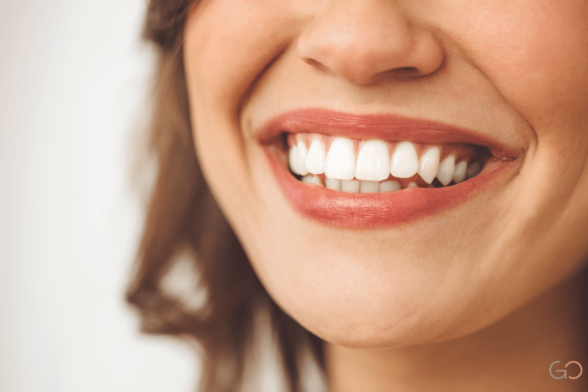 Lee más sobre el artículo Carillas dentales en pacientes con bruxismo: ¿son recomendables?