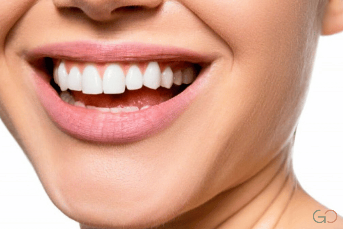 Lee más sobre el artículo Carillas dentales de zirconio vs porcelana: diferencias y cuál elegir