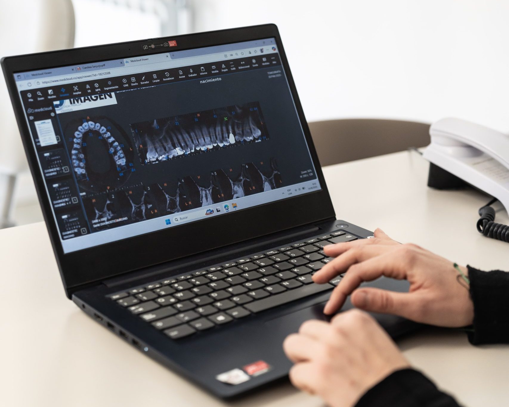 Lee más sobre el artículo Cirugía oral guiada por computador: precisión y recuperación más rápida