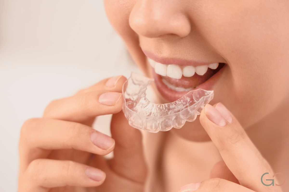 En este momento estás viendo Bruxismo nocturno: señales que indican que lo padecés sin saberlo