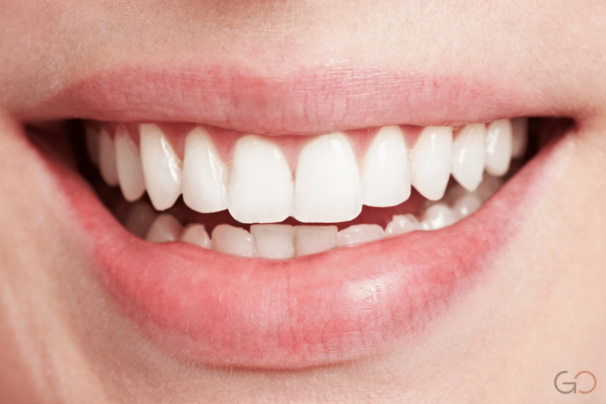 En este momento estás viendo Diseño digital de sonrisa (DSD): cómo planificamos el resultado antes de empezar