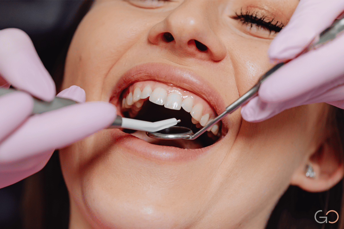 En este momento estás viendo Rehabilitación completa sin extraer dientes: ¿es posible?