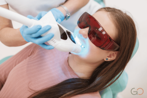 Lee más sobre el artículo ¿Cada cuánto se puede repetir un blanqueamiento dental?