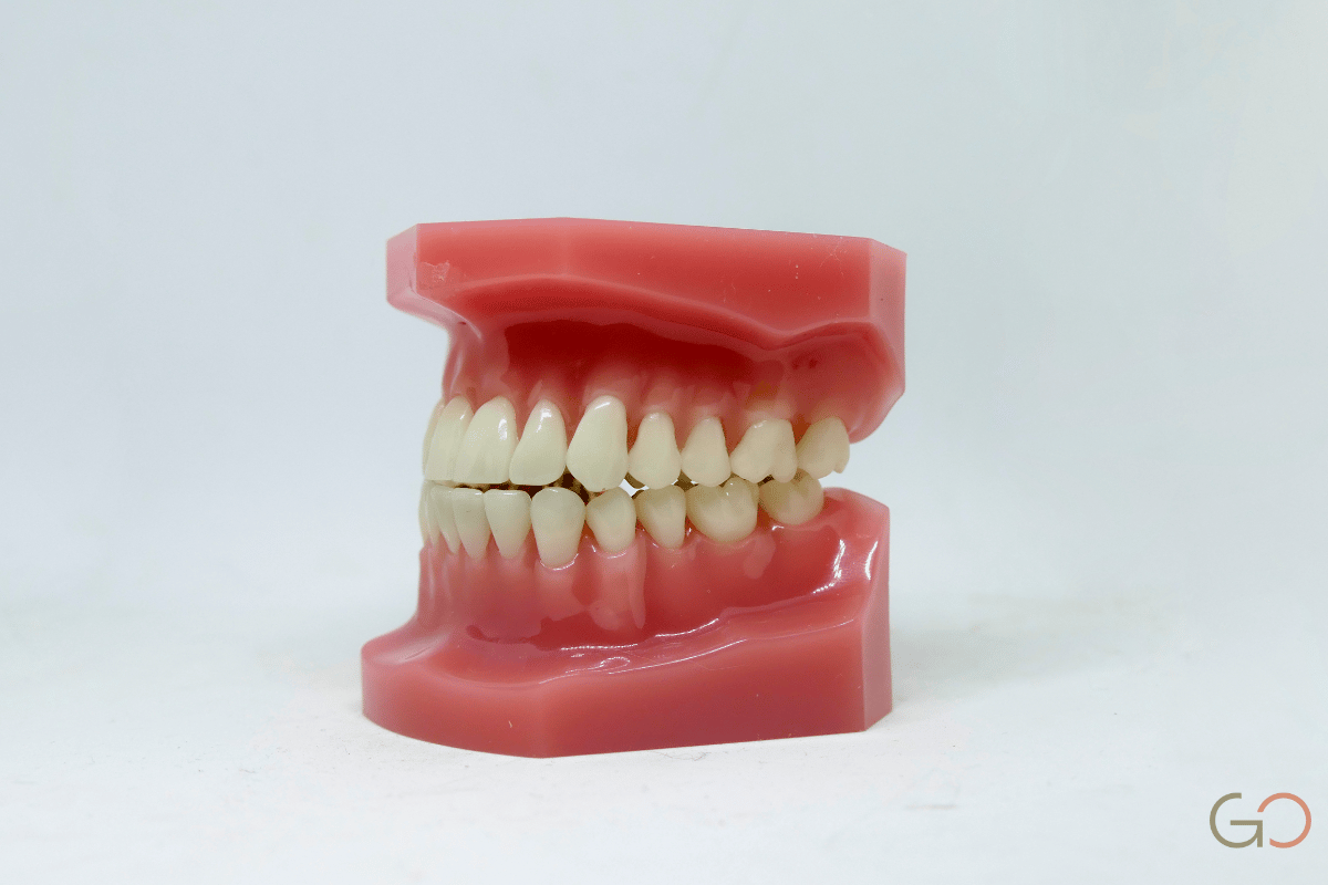 En este momento estás viendo Cirugía regenerativa periodontal: cómo se recupera el hueso perdido