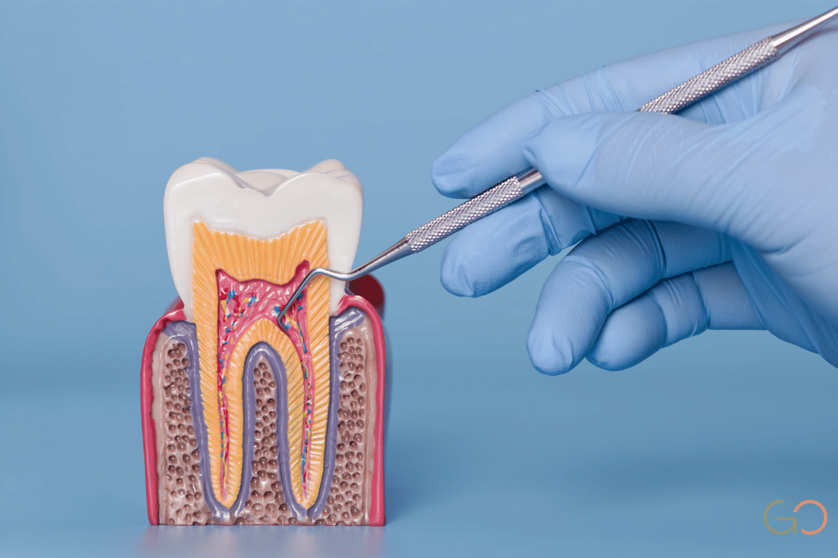 En este momento estás viendo Diente flojo por enfermedad periodontal: ¿se puede salvar o hay que extraerlo?