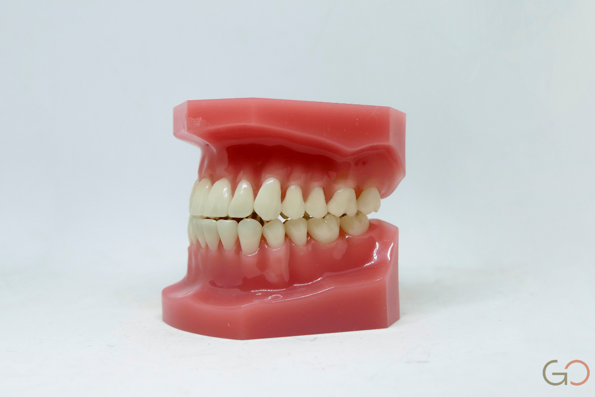 Lee más sobre el artículo ¿La enfermedad periodontal es hereditaria? Qué dice la genética