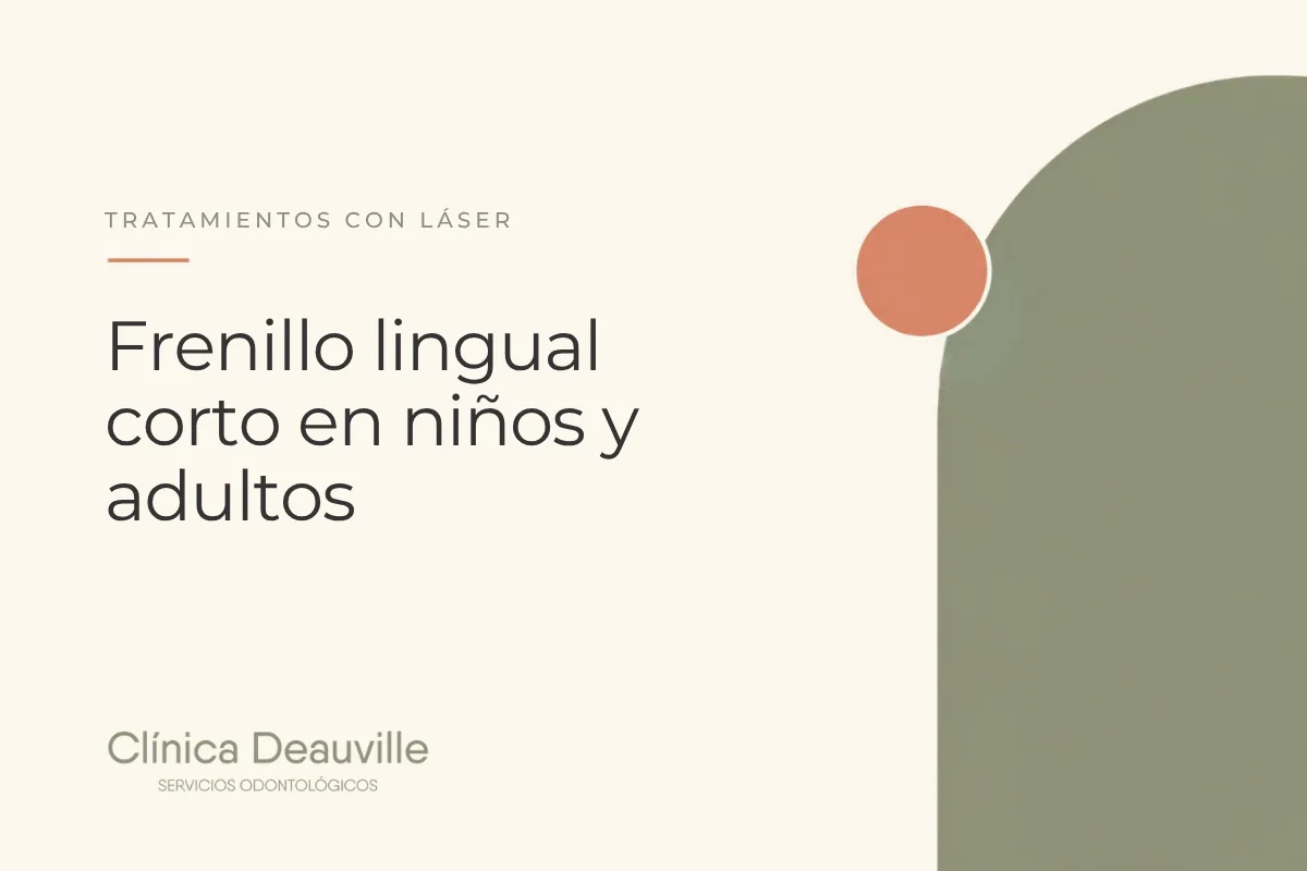 En este momento estás viendo Frenillo lingual corto en niños y adultos: efectos en el habla, la deglución y la respiración