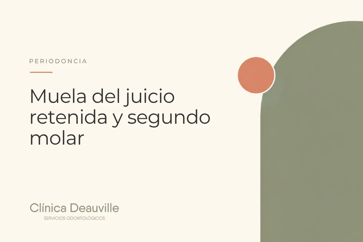 En este momento estás viendo Muela del juicio retenida y segundo molar: cómo daña el hueso y la encía del diente vecino