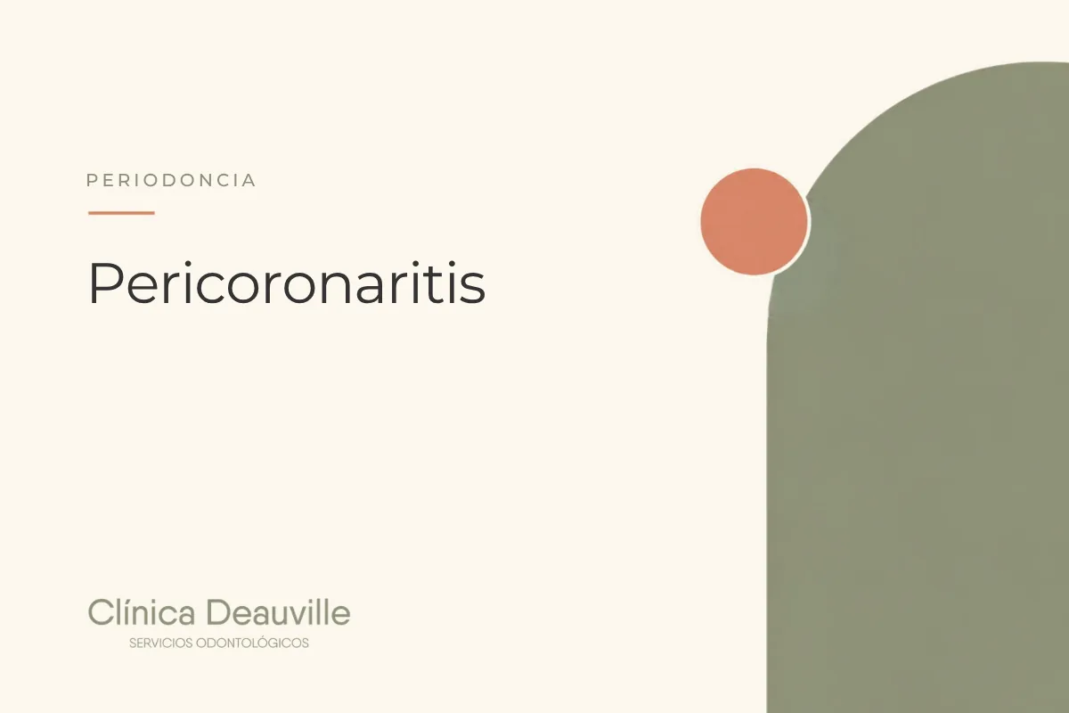 En este momento estás viendo Pericoronaritis: por qué se inflama la encía sobre la muela del juicio y cómo se trata