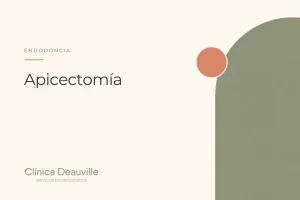 Lee más sobre el artículo Apicectomía: la cirugía que salva el diente cuando la endodoncia no alcanza