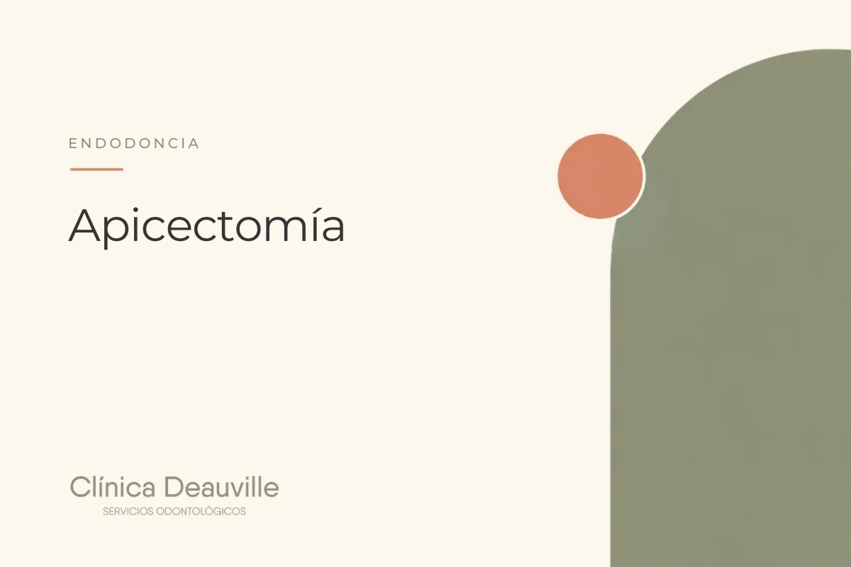 En este momento estás viendo Apicectomía: la cirugía que salva el diente cuando la endodoncia no alcanza