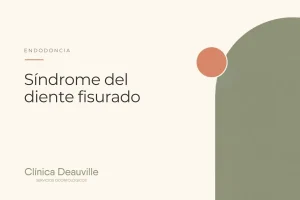 Síndrome del diente fisurado: dolor al morder y cuándo el diente se puede salvar